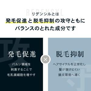 頭頂部・つむじの薄毛(AGA)に効果的な男性用...の詳細画像5