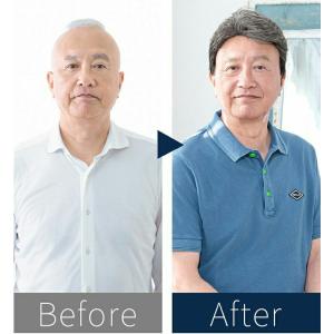 メンズウィッグ 男性用かつら かぶるタイプ 中...の詳細画像2