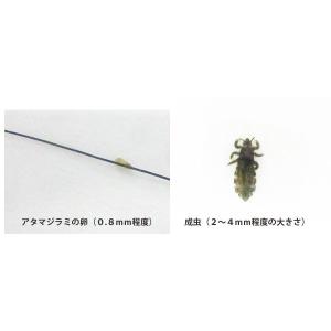 アタマジラミ 頭しらみ 電動シラミ駆除櫛 くし...の詳細画像1