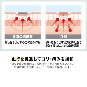 貼るだけ簡単鍼治療 マジコスポルト 鍼治療シー...の詳細画像5