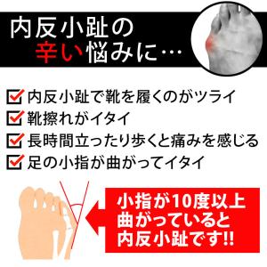 【2個セット】内反小趾セパレーター 内反小趾サ...の詳細画像1