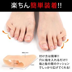 【2個セット】内反小趾セパレーター 内反小趾サ...の詳細画像3