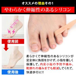 【2個セット】内反小趾セパレーター 内反小趾サ...の詳細画像4