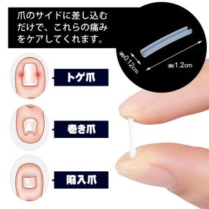 巻き爪 まきづめ ガード 巻き爪ブロック 巻き...の詳細画像2