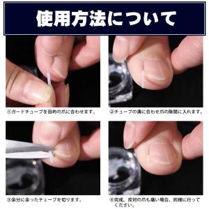 巻き爪 まきづめ ガード 巻き爪ブロック 巻き...の詳細画像5