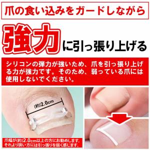 まきづめ 巻き爪 ケア ネイルケア まきづめ ...の詳細画像2