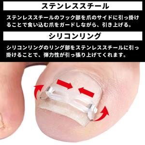 まきづめ 巻き爪 ケア ネイルケア まきづめ ...の詳細画像4