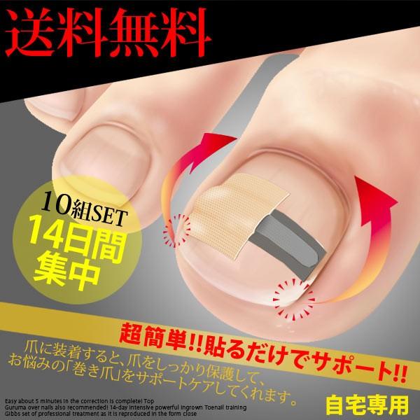 期間限定 ポイント10倍 巻き爪 矯正 巻き爪テープ まきづめリフト まきづめ 巻き爪ブロック 巻き...