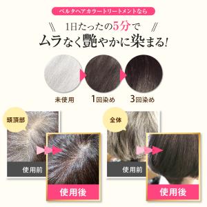 【ベルタ 公式】白髪染め 女性 カラートリート...の詳細画像3