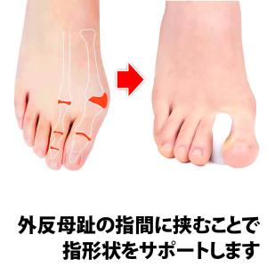 50%offクーポン有 外反母趾サポーター 足...の詳細画像3