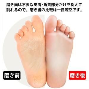 かかと 角質除去 ガラス かかとケア かかと ...の詳細画像4