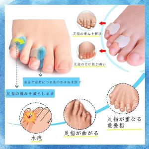 寝指 小指矯正グッズ 足 サポーター ないはん...の詳細画像3