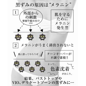 薬用 デリケートゾーン 黒ずみ クリーム 黒ず...の詳細画像3