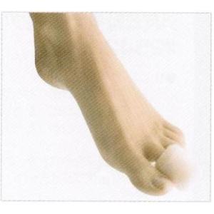 足のマメ・タコ 　ベルケマン　トゥーキャップ