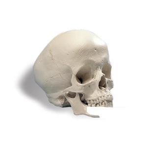 無料健康相談 対象製品 3B社  人体模型 　頭蓋骨模型 水頭症頭蓋モデル (a29-2) 　 鍼灸  模型｜biomedicalnet