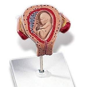 無料健康相談付 3B社　妊娠・胎児模型　妊娠3ヶ月の子宮モデル　（l10-3) 　　 smtb-s ...