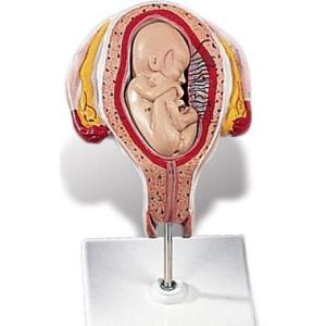 無料健康相談付 ソムソ社 15分解脳模型 bs25 鍼灸 模型 : Shop de