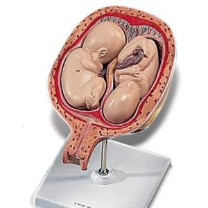 無料健康相談付 ソムソ社 15分解脳模型 bs25 鍼灸 模型 : Shop de