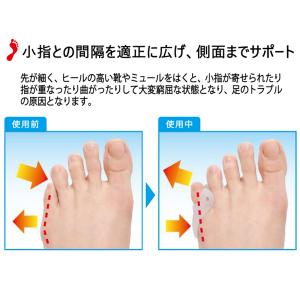 【メール便送料無料】 内反小趾 サポーター な...の詳細画像2