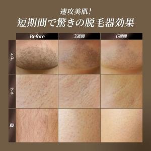 脱毛器 メンズ 髭 ハイパワー 1年保証 vi...の詳細画像2