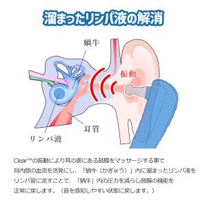 携帯用 鼓膜按摩器 Clear クリア メニエ...の詳細画像4