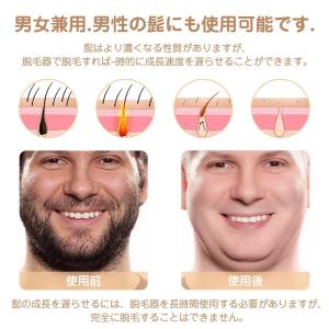 サロン級 脱毛器 IPL光脱毛器 ヒゲ ムダ毛...の詳細画像5