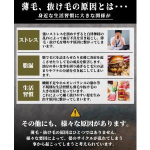 薬用 育毛剤 育毛 トニック STARS 発毛...の詳細画像2