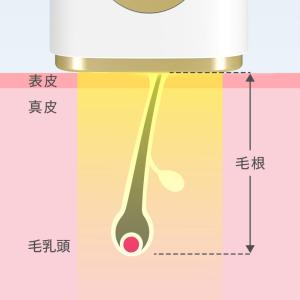 脱毛器 HIPL脱毛器 家庭用 光脱毛器 業界...の詳細画像4