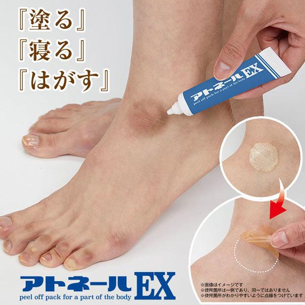 アトネールEX【ポスト投函送料無料】角質 角質ケア 角質パック 吸着パック