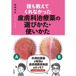誰も教えてくれなかった皮膚科治療薬の選びかた・使いかた/松田光弘