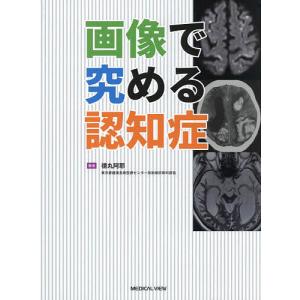 画像で究める認知症/徳丸阿耶