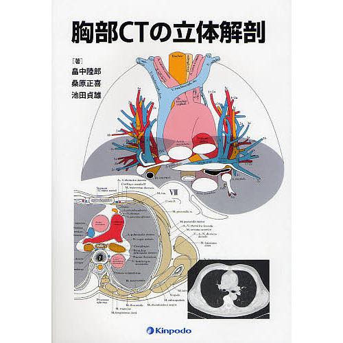 胸部CTの立体解剖/畠中陸郎/桑原正喜/池田貞雄