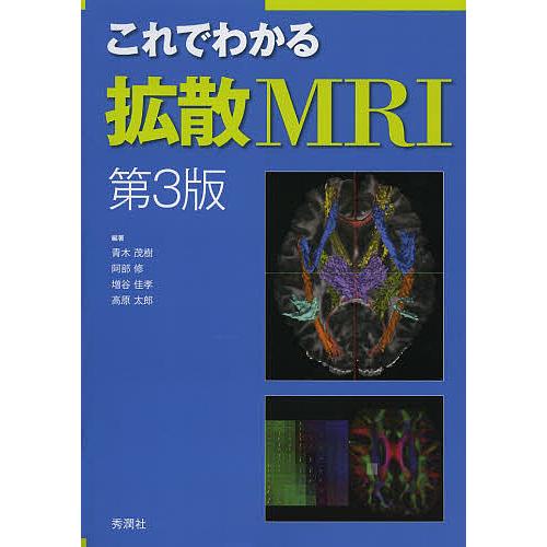 これでわかる拡散MRI/青木茂樹/阿部修/増谷佳孝