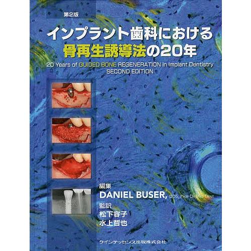 インプラント歯科における骨再生誘導法の20年/DanielBuser/松下容子/水上哲也
