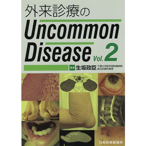 外来診療のUncommon Disease Vol.2/生坂政臣