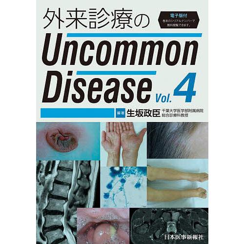 外来診療のUncommon Disease Vol.4/生坂政臣