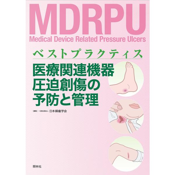 医療関連機器圧迫創傷の予防と管理 ベストプラクティス/日本褥瘡学会