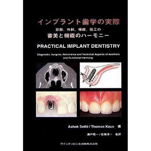 インプラント歯学の実際 診断、外科、補綴、技工の審美と機能のハーモニー/AshokSethi/Tho...