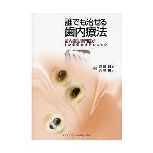 誰でも治せる歯内療法 歯内療法専門医が1から明かすテクニック