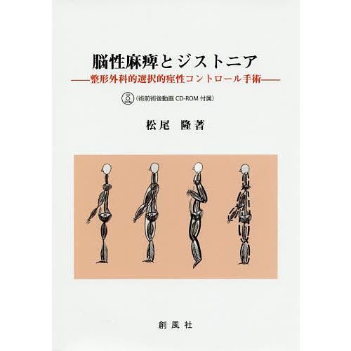 脳性麻痺とジストニア 整形外科的選択的痙性コントロール手術/松尾隆