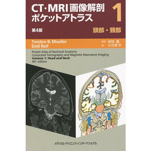 CT・MRI画像解剖ポケットアトラス 1/トルステンB．メーラー/エミールレイフ/町田徹