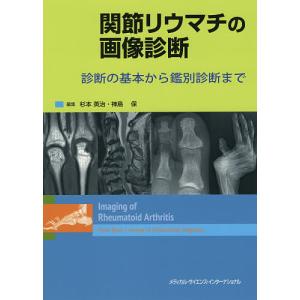 関節リウマチの画像診断 診断の基本から鑑別診断まで/杉本英治/神島保