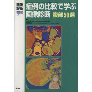 症例の比較で学ぶ画像診断 腹部50選 画像診断臨時増刊号2008vol.28No.4/大友邦(著者)...