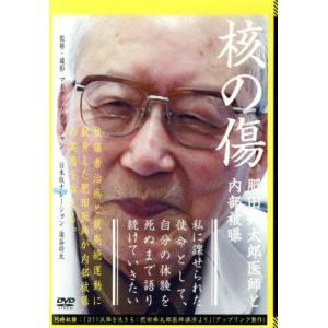 核の傷：肥田舜太郎医師と内部被曝／肥田舜太郎,染谷将太（ナレーション）,マーク・プティジャン（監督）