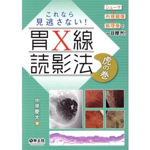これなら見逃さない！ 胃X線読影法 虎の巻 シェーマ+内視鏡像+病理像で一目瞭然！/中原慶太