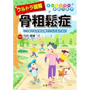 ウルトラ図解 骨粗鬆症 いつまでも丈夫な骨でいられるために オールカラー家庭の医学/竹内靖博(監修)