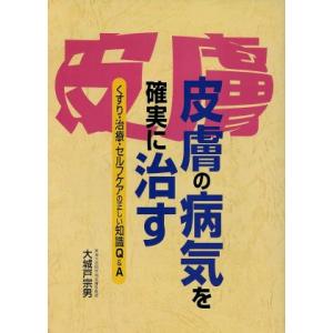 皮膚の病気を確実に治す くすり・治療・セルフケアの正しい知識Q&A/大城戸宗男(著者)　