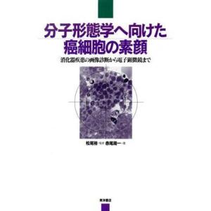 癌細胞の素顔と画像診断の高価買取価格