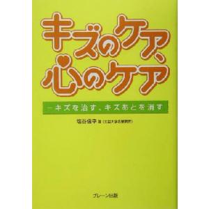 キズのケア、心のケア キズを治す、キズあとを消す／塩谷信幸(著者)