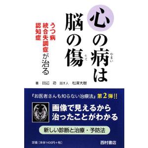 心の病は脳の傷 うつ病・統合失調症・認知症が治る／田辺功【著】，松澤大樹【話】